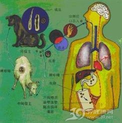 包虫病
