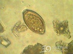 鞭虫病