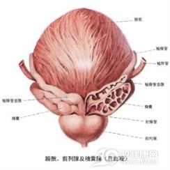 膀胱平滑肌瘤