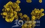 布鲁氏菌病