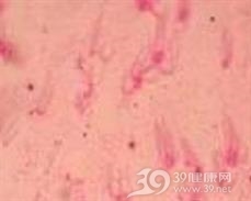 变形杆菌食物中毒
