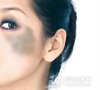斑状萎缩