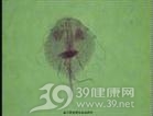 肠梨形鞭毛虫病