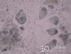 肠毛滴虫病