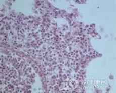 肠球菌肺炎
