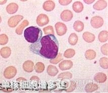 传染性淋巴细胞增多症