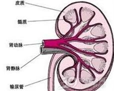单纯肾异位