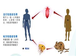 地方性斑疹伤寒