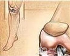 单发性骨软骨瘤
