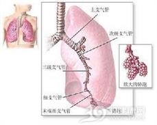 肺不发育或发育不全
