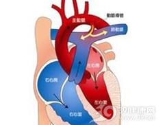 肺动脉高压