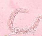 粪类圆线虫病