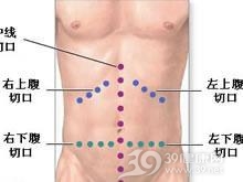 腹膜后脓肿