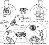 腹腔肺吸虫病
