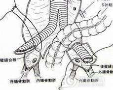 腹主动脉腔静脉瘘