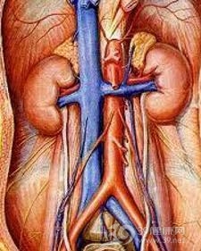 腹主动脉缩窄