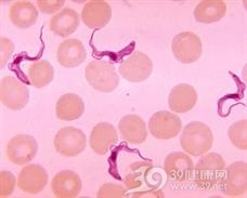 非洲锥虫病