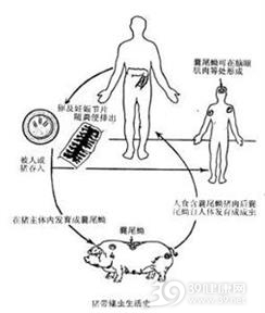骨包囊虫病