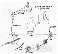 钩虫皮炎