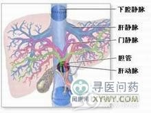 肝动脉闭塞