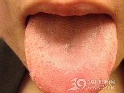 肝胆湿热