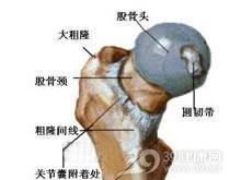 股骨大粗隆结核