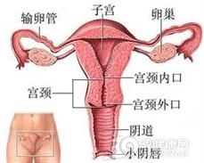 宫颈性不孕