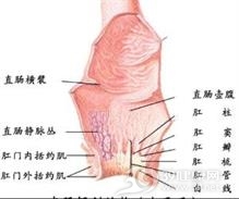 肛门息肉