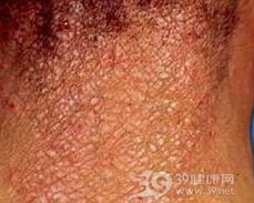 光泽苔藓