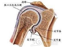喙突胸小肌综合征