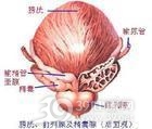 结核性膀胱自发破裂