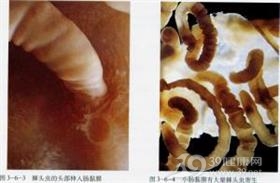 巨吻棘头虫病