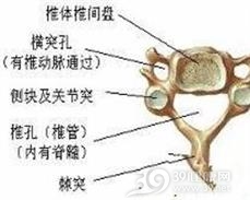 颈椎半椎体畸形
