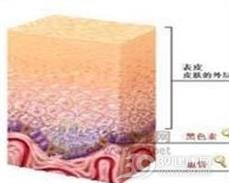 立克次体痘