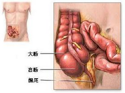 老年人急腹症