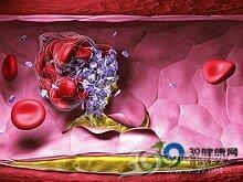 老年人血栓性疾病