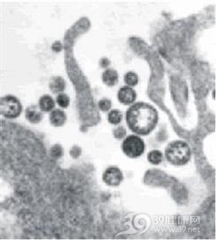 拉沙热