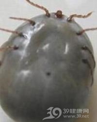 寄生虫