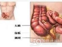 阑尾肿瘤