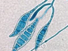 毛孢子菌病