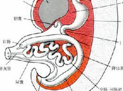 盲肠扭转