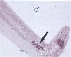 湄公血吸虫病