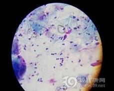 马拉色菌病