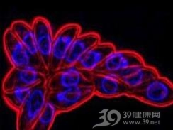 皮肤弓形体病
