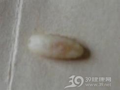 皮肤蝇蛆病