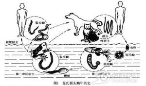 皮下裂头蚴病