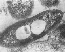 其他弧菌感染