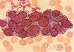 软骨母细胞瘤