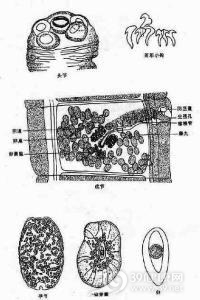 瑞列绦虫病