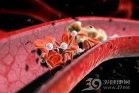 妊娠合并血栓性疾病